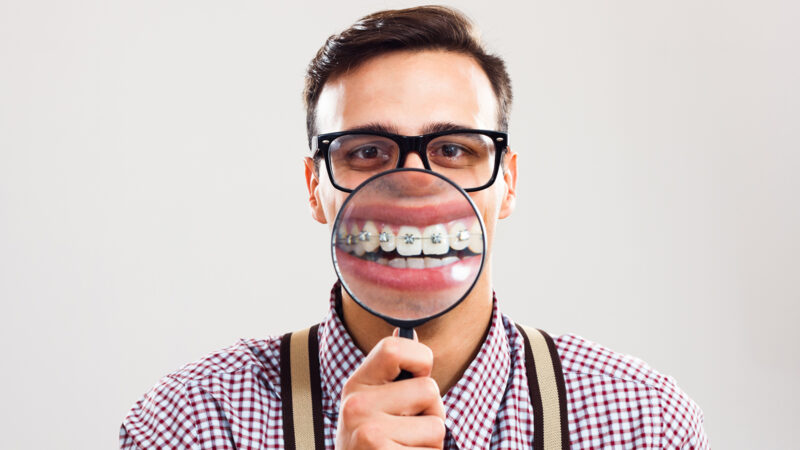 Nerdy man is holding loupe and showing his teeth with braces.I have braces and I am still handsome!